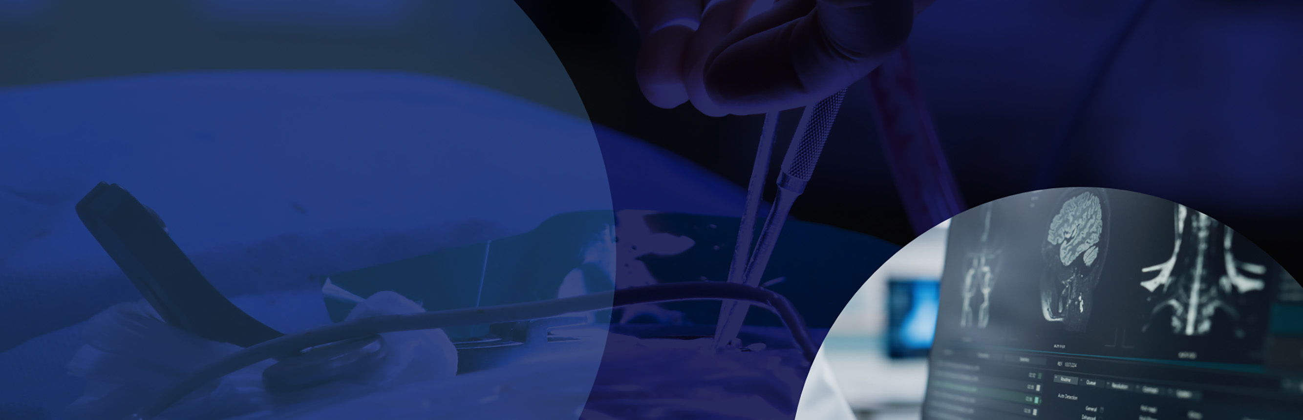 Patient Journey, Workflow Analysis & Unmet Need Assessment for a Patient Monitoring Portfolio